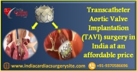 Transcatheter Aortic Valve Implantation (TAVI) surgery in India